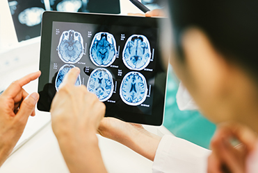 doctor looking at brain scans on a tablet